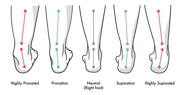 What Is Foot Pronation And Foot Supination? Is It Good Or Bad?