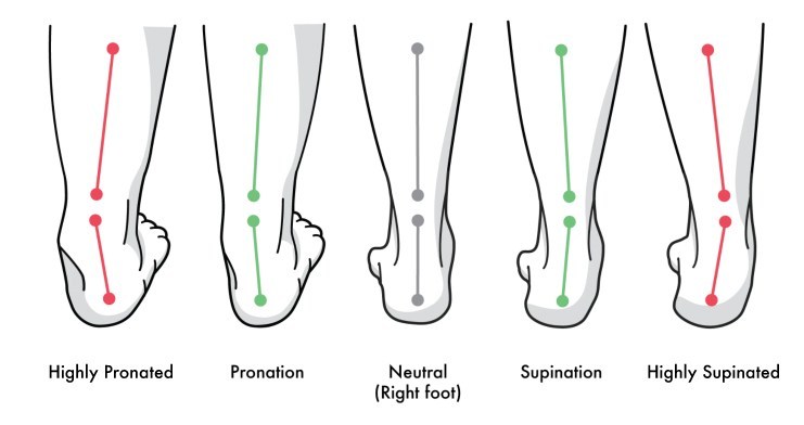 Moderate pronation 2025