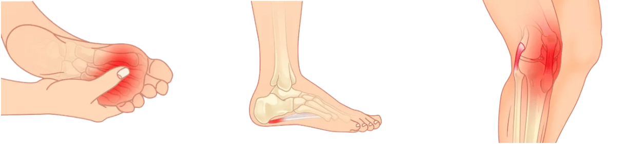 Foot Pain Tips To Relieve Workplace Foot Pain Walking Mobility Clinics